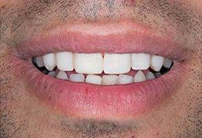 Cosmetic Dentist in Bayonne