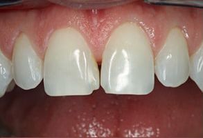 Cosmetic Dentist in Bayonne
